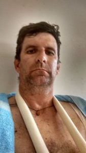 Recebe alta do hospital jornalista vítima de bala perdida em Osório